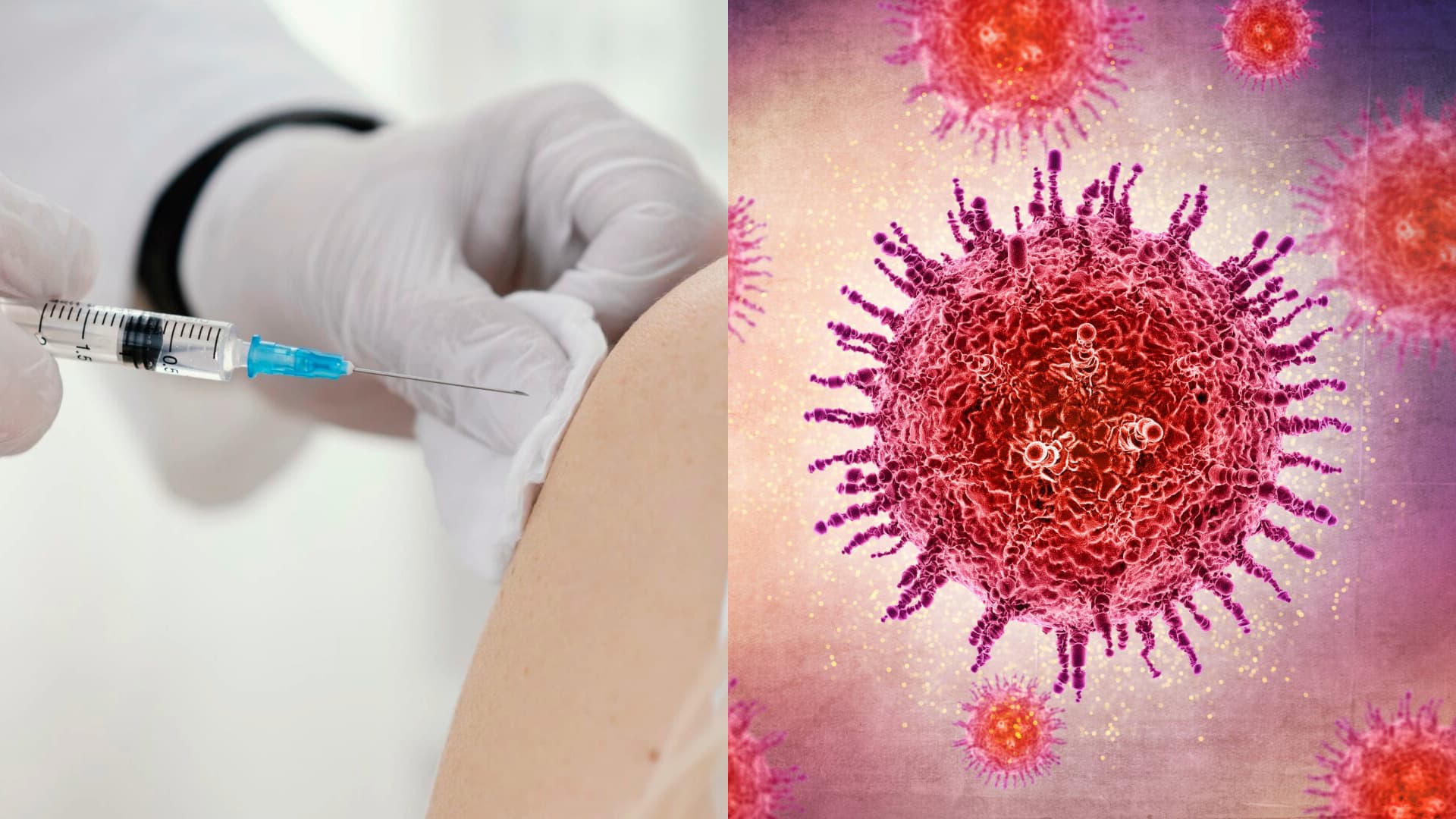 HPV spôsobuje tisíce prípadov rakoviny ročne. Očkovanie je kľúčom k prevencii